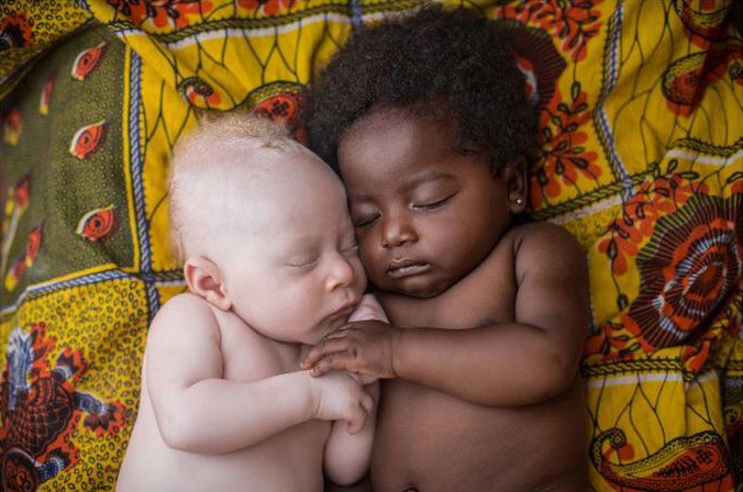 Trojtýždňové novorodeniatko s albinizmom spokojne spí s jeho sesternicou.