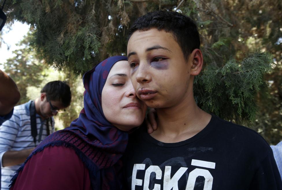 Tariq Khdeir je vítaný svojou matkou po tom, čo bol prepustený z väzenia v Jeruzaleme. 6.7.2014.