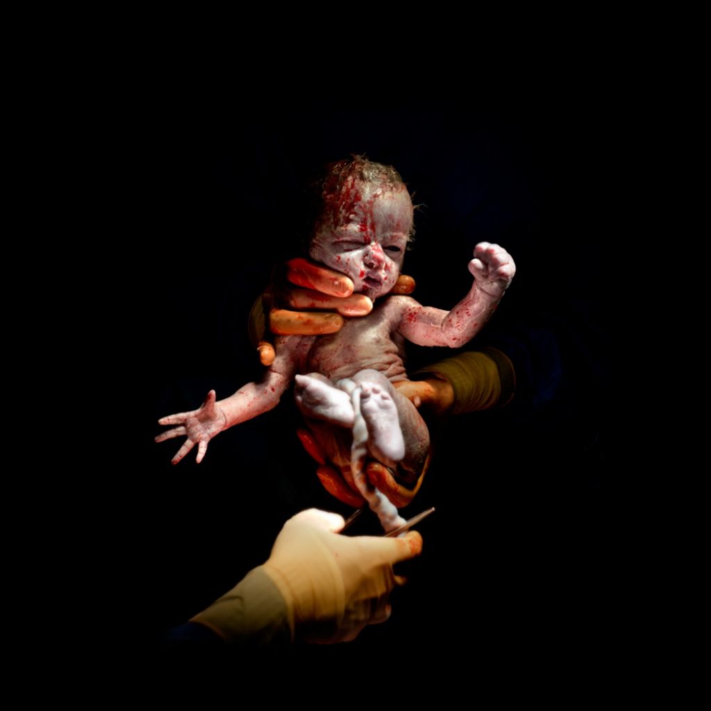 Leanne, narodená 8. apríla 2014 o 8:31 hod, 1,745 kg. Odfotená 13 sekúnd po pôrode.