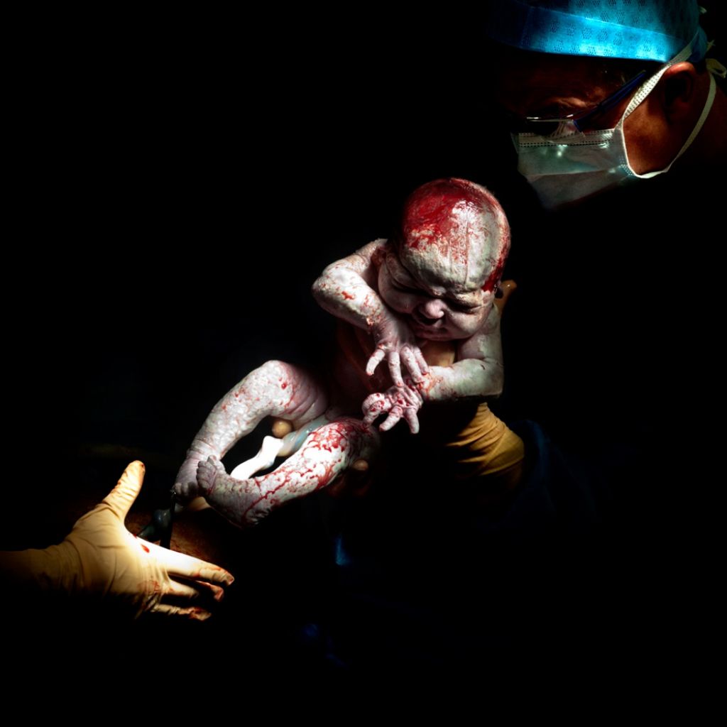 Louann, narodený 12. apríla 2013 o 8:40 hod., 3,57 kg. Odfotený 14 sekúnd po pôrode.