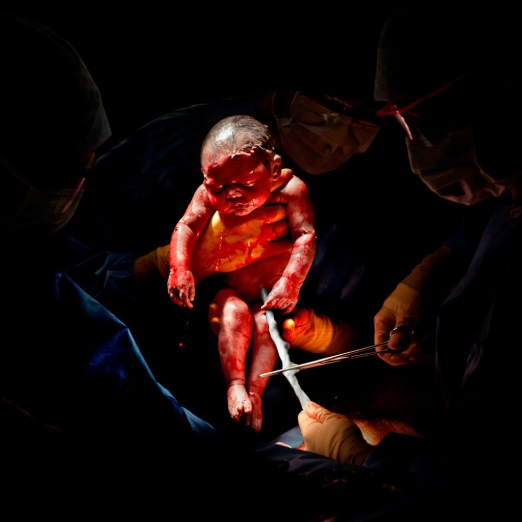 Liza, narodená 26. februára 2013 o 8:45 hod., 3,2 kg. Odfotená 3 sekúndy po pôrode.