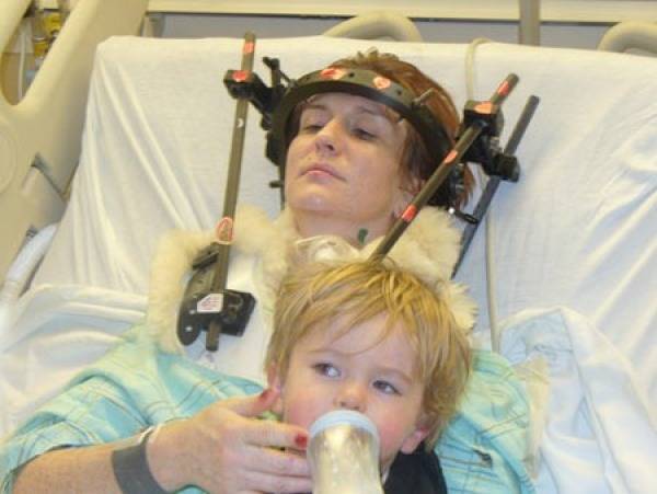 Tomuto príbehu sa nám nechce veriť. V roku 2007 Shannon Malloy prekonala autonehodu, po ktorej sa jej lebka oddelila od tela. Jej miecha však zostala nepoškodená. Podľa jej výpovede si pamätá, že svoju hlavu vôbec nevedela ovládať a hýbať s ňou. Toto zranenie je známe ako "interné oddelenie hlavy". V nemocnici jej do hlavy a krk spojili spolu deviatimi skrutkami. Stále má problémy s prehĺtaním, má poškodené očné nervy, ale žije a stále pracuje na tom, aby sa jej zdravotný stav zlepšil.