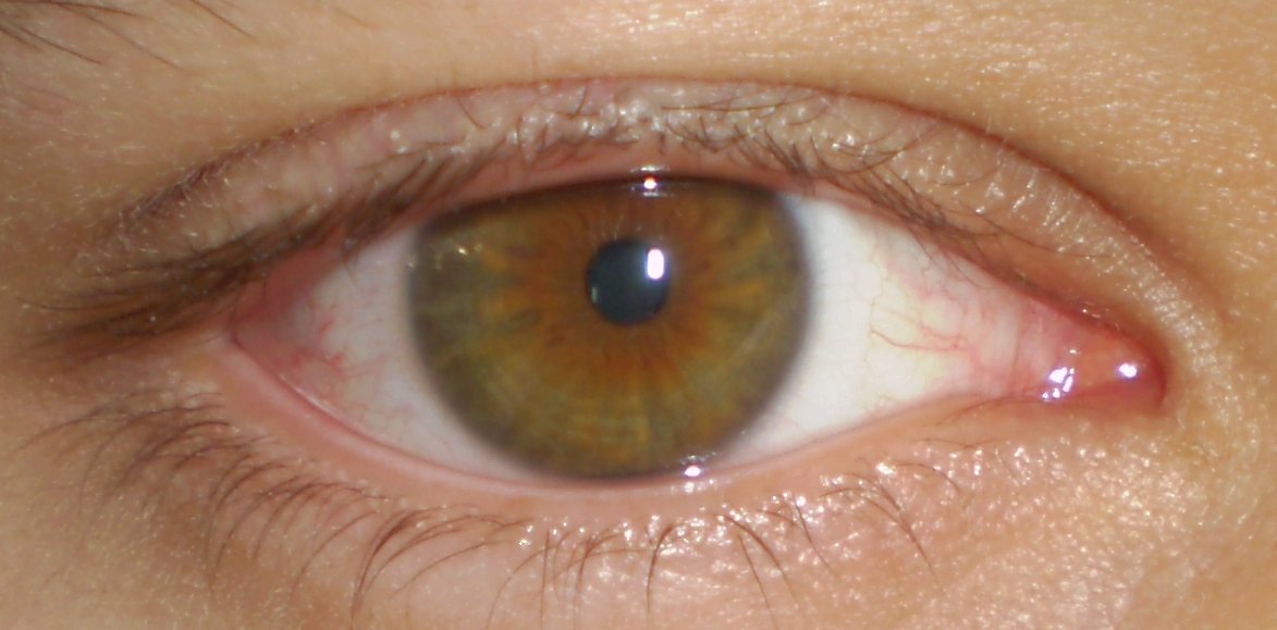 eye-colour6